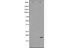 Western blot analysis on COS7 cell lysate using p18 INK Antibody,The lane on the left is treated with the antigen-specific peptide. (P18 INK Antikörper)