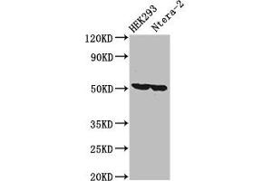 Western Blot Positive WB detected in: HEK293 whole cell lysate, Ntera-2 whole cell lysate All lanes: RUVBL1 antibody at 3. (RUVBL1 Antikörper  (AA 101-400))