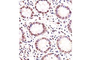 Paraformaldehyde-fixed, paraffin embedded human small intestine tissue, Antigen retrieval by boiling in sodium citrate buffer (pH6. (MGMT Antikörper)