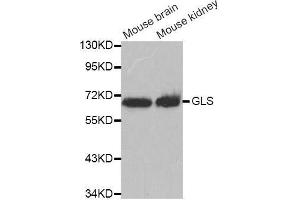 Western blot analysis of extracts of various cell lines, using GLS antibody. (Glutaminase Antikörper  (AA 610-669))