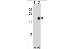 Western blot analysis of NIP7 (arrow) using rabbit polyclonal NIP7 Antibody (C-term) (ABIN652635 and ABIN2842425). (NIP7 Antikörper  (C-Term))
