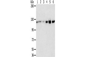 Western Blotting (WB) image for anti-RNA Binding Motif Protein 5 (RBM5) antibody (ABIN2430715) (RBM5 Antikörper)
