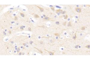 Immunohistochemistry (IHC) image for anti-Nuclear Factor (erythroid-Derived 2)-Like 2 (NFE2L2) (AA 400-603) antibody (ABIN7441673)
