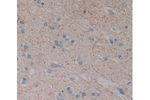 Used in DAB staining on fromalin fixed paraffin- embedded brain tissue (DLG5 Antikörper  (AA 1722-1905))