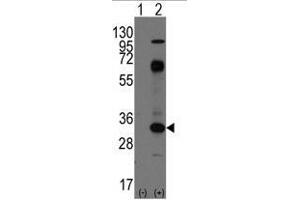 Image no. 1 for anti-CD8 (CD8) (C-Term) antibody (ABIN356888) (CD8 Antikörper  (C-Term))