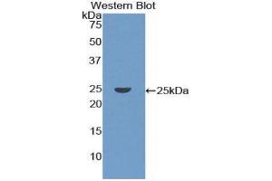 Western Blotting (WB) image for anti-Coronin, Actin Binding Protein, 1A (CORO1A) (AA 7-204) antibody (ABIN1858472) (Coronin 1a Antikörper  (AA 7-204))