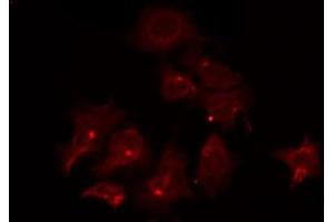 ABIN6266797 staining COLO205 by IF/ICC. (ATF6B Antikörper  (Internal Region))