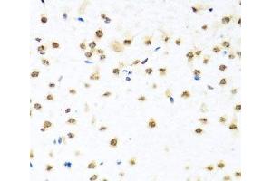Immunohistochemistry of paraffin-embedded Mouse brain using RAB3IP Polyclonal Antibody at dilution of 1:100 (40x lens).
