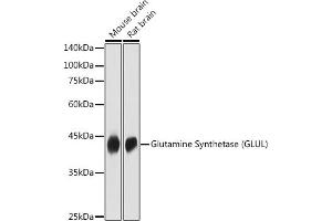 Western blot analysis of extracts of various cell lines, using Glutamine Synthetase (GLUL) antibody (ABIN6130425, ABIN6141161, ABIN6141162 and ABIN7101772) at 1:1000 dilution. (GLUL Antikörper  (AA 1-373))