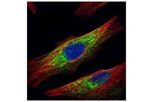 ICC/IF Image Confocal immunofluorescence analysis (Olympus FV10i) of paraformaldehyde-fixed HeLa, using HDAC6, antibody (Green) at 1:500 dilution. (HDAC6 Antikörper  (N-Term))