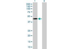 Western Blot analysis of DLST expression in transfected 293T cell line by DLST MaxPab polyclonal antibody. (DLST Antikörper  (AA 1-453))