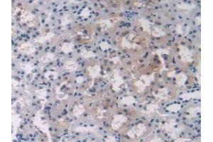IHC-P analysis of Rat Liver Tissue, with DAB staining. (OAS1 Antikörper  (AA 139-358))