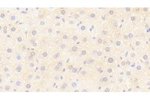 Detection of Flt3L in Mouse Liver Tissue using Polyclonal Antibody to FMS Like Tyrosine Kinase 3 Ligand (Flt3L) (FLT3LG Antikörper  (AA 27-189))