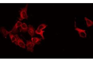 ABIN6266543 staining LOVO by IF/ICC. (GAD Antikörper  (C-Term))