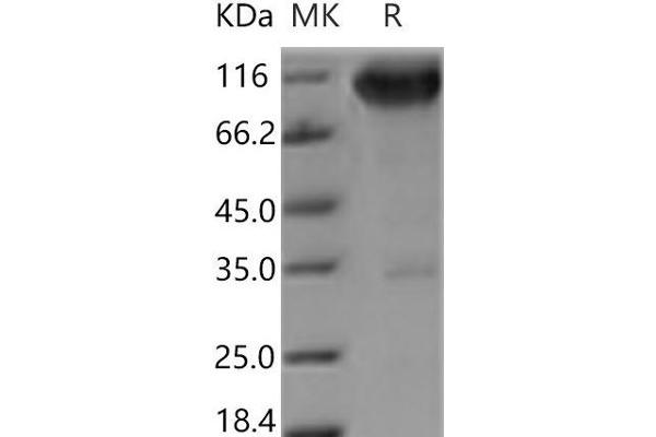 TRKA Protein (Fc Tag)