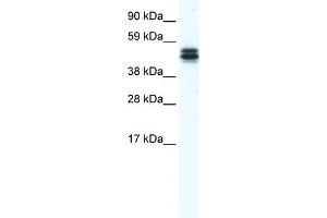 WB Suggested Anti-E130307M08RIK Antibody Titration:  1. (MPND Antikörper  (Middle Region))