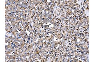 IHC analysis of MPPB/PMPCB using anti-MPPB/PMPCB antibody (ABIN7600758). (PMPCB Antikörper  (AA 23-479))