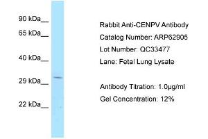 Western Blotting (WB) image for anti-Centromere Protein V (CENPV) (C-Term) antibody (ABIN2789289) (CENPV Antikörper  (C-Term))