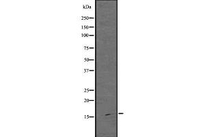 Western Blotting (WB) image for anti-Actin Related Protein 2/3 Complex, Subunit 5, 16kDa (ARPC5) (N-Term) antibody (ABIN6260048)