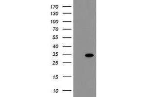 Image no. 1 for anti-RNA Binding Protein with Multiple Splicing (RBPMS) antibody (ABIN1500649) (RBPMS Antikörper)