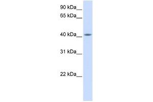 FAM54A antibody used at 1 ug/ml to detect target protein. (FAM54A Antikörper  (Middle Region))