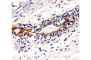 IHC analysis of Kit using anti-Kit antibody (ABIN7825521).