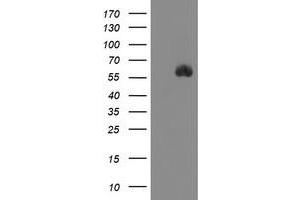 Image no. 1 for anti-serine Peptidase Inhibitor, Kunitz Type 1 (SPINT1) antibody (ABIN1501110) (SPINT1 Antikörper)
