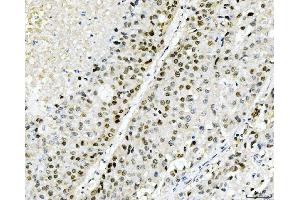 IHC analysis of Cyclophilin E/PPIE using anti-Cyclophilin E/PPIE antibody (ABIN7599242). (PPIE Antikörper  (AA 1-301))