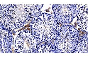 Detection of NOTCH2NL in Mouse Testis Tissue using Polyclonal Antibody to Notch2 N-Terminal Like Protein (NOTCH2NL) (NOTCH2NL Antikörper  (AA 1-236))