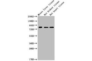 Western Blot Positive WB detected in: MMUT antibody at 1:1000 Lane 1: Mouse liver tissue Lane 2: Rat kidney tissue Lane 3: Rat heart tissue Secondary Goat polyclonal to Mouse IgG at 1/20000 dilution Predicted band size: 83 KDa Observed band size: 83 KDa Exposure time: 5 min (Histone 3 Antikörper  (AA 31-748))