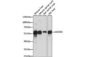 Western blot analysis of extracts of various cell lines, using HOXD3 antibody (ABIN6290493) at 1:1000 dilution. (HOXD3 Antikörper)