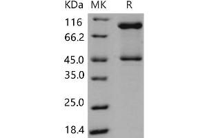 Western Blotting (WB) image for serpin Peptidase Inhibitor, Clade B (Ovalbumin), Member 3 (SERPINB3) protein (His tag) (ABIN7320213) (SERPINB3 Protein (His tag))