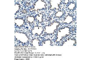 Rabbit Anti-EMP2 Antibody  Paraffin Embedded Tissue: Human Lung Cellular Data: Alveolar cells Antibody Concentration: 4. (EMP2 Antikörper  (Middle Region))