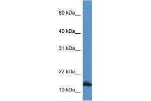Western Blot showing CDA antibody used at a concentration of 1 ug/ml against HepG2 Cell Lysate (CDA Antikörper  (C-Term))