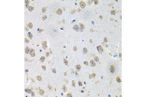 Immunohistochemistry of paraffin-embedded mouse brain using GNE antibody (ABIN5996449) at dilution of 1/100 (40x lens). (GNE Antikörper)