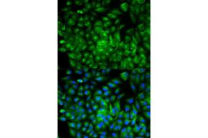 Immunofluorescence analysis of A549 cell using ATG16L1 antibody. (ATG16L1 Antikörper  (AA 90-300))