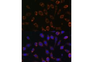 Immunofluorescence analysis of L929 cells using TCIRG1 Polyclonal Antibody (ABIN7270707) at dilution of 1:100 (40x lens). (TCIRG1 Antikörper  (AA 1-130))