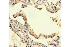 Immunohistochemistry of paraffin-embedded human lung tissue using ABIN7168811 at dilution of 1:100 (SEMA5A Antikörper  (AA 201-400))