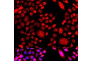 Immunofluorescence analysis of A549 cells using RAC3 Polyclonal Antibody (RAC3 Antikörper)