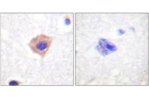 Immunohistochemistry analysis of paraffin-embedded human brain tissue, using Catalase (Ab-385) Antibody. (Catalase Antikörper  (AA 361-410))