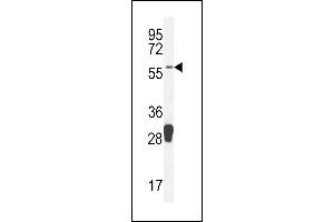 MOCS1 Antikörper  (C-Term)