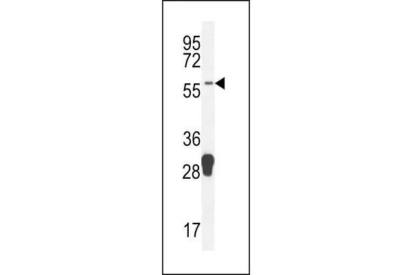 MOCS1 Antikörper  (C-Term)