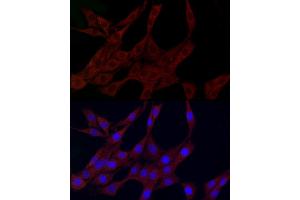 Immunofluorescence analysis of PC-12 cells using PLK2 Rabbit pAb (ABIN6132905, ABIN6145776, ABIN6145778 and ABIN6222860) at dilution of 1:150 (40x lens). (PLK2 Antikörper  (AA 322-671))