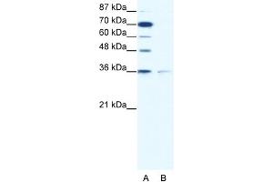 WB Suggested Anti-ZNF326 Antibody Titration: 1. (ZNF326 Antikörper  (C-Term))
