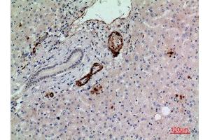 Immunohistochemistry (IHC) analysis of paraffin-embedded Human Liver, antibody was diluted at 1:100. (RHAG Antikörper  (N-Term))