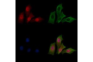ABIN7094272 and ABIN7098319 staining HepG2 cells by IF/ICC.