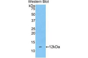 Western blot analysis of the recombinant protein. (FGA Antikörper  (AA 554-655))
