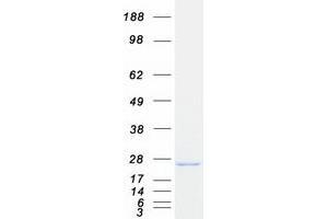 Validation with Western Blot (CIB1 Protein (Myc-DYKDDDDK Tag))