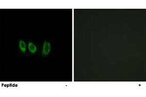Immunofluorescence analysis of A-549 cells, using CSTL1 polyclonal antibody . (CSTL1 Antikörper)