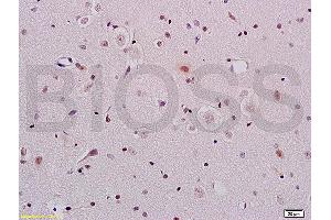 Formalin-fixed and paraffin embedded rat brain tissue labeled with Anti-ERCC1 Polyclonal Antibody, Unconjugated (ABIN733553) at 1:200 followed by conjugation to the secondary antibody and DAB staining (ERCC1 Antikörper  (AA 151-250))